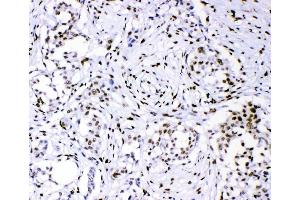IHC analysis of PML using anti-PML antibody (ABIN4886699).