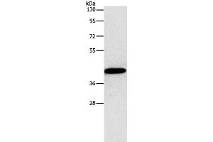 Western Blot analysis of MCF7 cell using Connexin-45 Polyclonal Antibody at dilution of 1:1250 (GJC1 Antikörper)