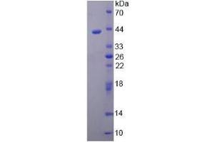 SDS-PAGE analysis of Human ARTN Protein. (ARTN Protein)