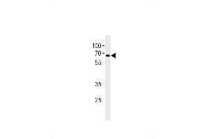 Western blot analysis in CEM cell line lysates (35ug/lane). (ZNF90 Antikörper  (AA 84-112))