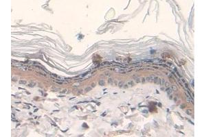 Detection of FASN in Rat Skin Tissue using Polyclonal Antibody to Fatty Acid Synthase (FASN) (Fatty Acid Synthase Antikörper  (AA 2243-2505))