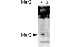 Image no. 1 for anti-CD151 (CD151) (AA 26-35), (pSer30) antibody (ABIN401337) (CD151 Antikörper  (pSer30))