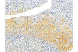 ABIN6264259 and ABIN6273065 at 1/100 staining Rat kidney tissue by IHC-P. (PKLR Antikörper  (Internal Region))
