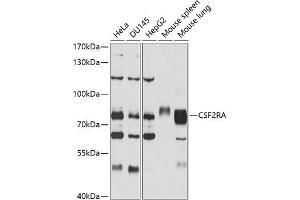 Western blot analysis of extracts of various cell lines, using CSF2RA antibody (ABIN3022748, ABIN3022749, ABIN1512778 and ABIN6219208) at 1:1000 dilution. (CSF2RA Antikörper  (AA 23-320))