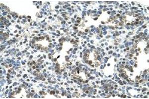 Immunohistochemical staining (Formalin-fixed paraffin-embedded sections) of human lung with GPNMB polyclonal antibody  at 4-8 ug/mL working concentration. (Osteoactivin Antikörper  (N-Term))