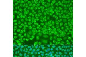 Immunofluorescence analysis of U2OS cells using PNKD Polyclonal Antibody at dilution of 1:100. (PNKD Antikörper)