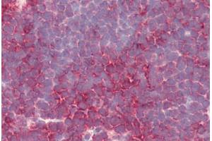 Human Thymus (formalin-fixed, paraffin-embedded) stained with PSENEN antibody ABIN461899 at 5 ug/ml followed by biotinylated goat anti-rabbit IgG secondary antibody ABIN481713, alkaline phosphatase-streptavidin and chromogen. (PEN2 Antikörper  (N-Term))