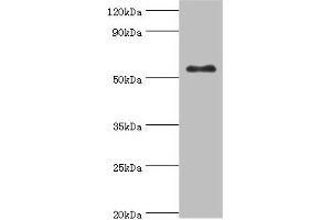 Western blot All lanes: Glucokinase antibody at 8 μg/mL + HepG2 whole cell lysate Secondary Goat polyclonal to rabbit IgG at 1/10000 dilution Predicted band size: 52 kDa Observed band size: 52 kDa (GCK Antikörper  (AA 1-300))