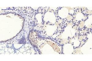 Immunohistochemistry of paraffin-embedded Rat lung tissue with Phospho-Stat1 (Tyr701) Polyclonal Antibody at dilution of 1:200 (STAT1 Antikörper  (pTyr701))