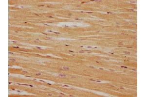 Immunohistochemistry (IHC) image for anti-Protein Phosphatase, Mg2+/Mn2+ Dependent, 1L (PPM1L) (AA 128-343) antibody (ABIN7165960)
