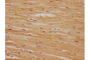 IHC image of ABIN7165960 diluted at 1:100 and staining in paraffin-embedded human heart tissue performed on a Leica BondTM system. (PPM1L Antikörper  (AA 128-343))