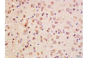 Formalin-fixed and paraffin embedded rat brain labeled with Anti-Erbin Polyclonal Antibody, Unconjugated  at 1:200 followed by conjugation to the secondary antibody and DAB staining.