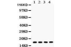 Western Blotting (WB) image for anti-Stathmin 1 (STMN1) (AA 2-34), (N-Term) antibody (ABIN3043301) (Stathmin 1 Antikörper  (N-Term))