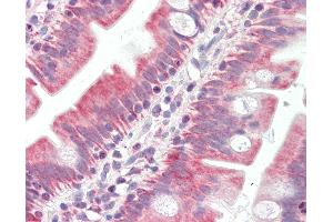 Anti-BAK1 / BAK antibody IHC of human small intestine.