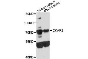 Western blot analysis of extracts of various cell lines, using CKAP2 antibody (ABIN5996642) at 1:3000 dilution. (CKAP2 Antikörper)