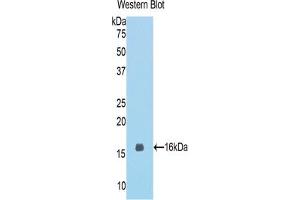 Western blot analysis of the recombinant protein. (MGEA5 Antikörper  (AA 679-808))
