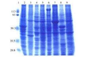 SDS-PAGE (SDS) image for Rat Normal Tissue Blot I (ABIN2455974) (Ratte Normal Tissue Blot I)