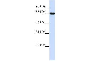 Leiomodin 1 antibody used at 1 ug/ml to detect target protein. (Leiomodin 1 Antikörper)