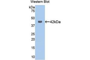 Western blot analysis of the recombinant protein. (KRT16 Antikörper  (AA 117-419))
