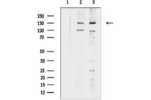 anti-Palladin, Cytoskeletal Associated Protein (PALLD) (Internal Region) antibody