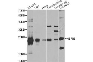 Western blot analysis of extracts of various cell lines, using HSPB8 antibody (ABIN5971347) at 1/1000 dilution. (HSPB8 Antikörper)