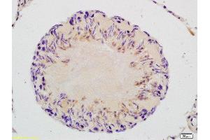Formalin-fixed and paraffin embedded rat testis labeled with Rabbit Anti-GAPDHS/GAPDH2 Polyclonal Antibody, Unconjugated  at 1:200 followed by conjugation to the secondary antibody and DAB staining (GAPDHS Antikörper  (AA 251-350))