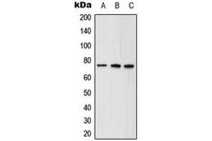 Western blot analysis of ABCD1 expression in HeLa (A), mouse brain (B), rat kidney (C) whole cell lysates. (ABCD1 Antikörper  (Center))