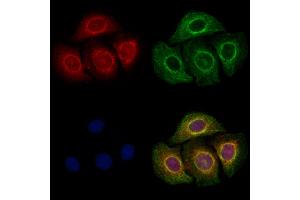ABIN6257891 and ABIN6273815 staining Hela cells by IF/ICC. (TRIO Antikörper  (Internal Region))