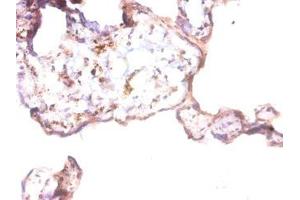 Immunohistochemistry of paraffin-embedded human placenta tissue using ABIN7144088 at dilution of 1:50 (Angiopoietin 1 Antikörper  (AA 16-498))