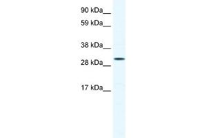 WB Suggested Anti-SOX12 Antibody Titration: 0. (SOX12 Antikörper  (C-Term))
