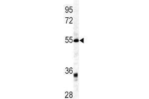 Western Blotting (WB) image for anti-Growth Differentiation Factor 6 (GDF6) antibody (ABIN3003243)