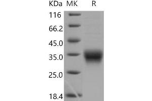 Western Blotting (WB) image for CD8a Molecule (CD8A) (Active) protein (His tag) (ABIN7320295) (CD8 alpha Protein (His tag))