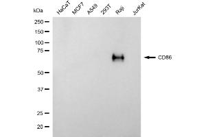 Western blotting analysis using CD86 antibody (ABIN7797985). (CD86 Antikörper)