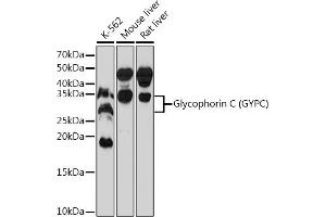 Western blot analysis of extracts of various cell lines, using Glycophorin C (GYPC) (GYPC) Rabbit mAb (ABIN7267476) at 1:1000 dilution.
