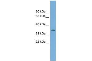 WB Suggested Anti-C3orf49 Antibody Titration: 0. (C3orf49 Antikörper  (Middle Region))