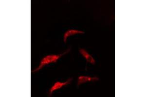 ABIN6274864 staining HeLa cells by IF/ICC. (ARMC6 Antikörper  (C-Term))