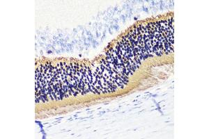 Immunohistochemistry of paraffin-embedded rat retina using PDC antibody (ABIN6132871, ABIN6145332, ABIN6145333 and ABIN6224509) at dilution of 1:200 (40x lens). (Phosducin Antikörper  (AA 1-246))