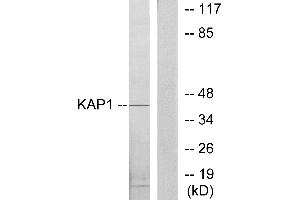 Western blot analysis of extracts from COLO205 cells, using KAP1 antibody. (KAP1 Antikörper  (Internal Region))