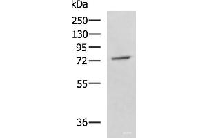 Western blot analysis of A549 cell lysate using GPCPD1 Polyclonal Antibody at dilution of 1:800 (GPCPD1 Antikörper)