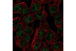 Immunofluorescent staining of HepG2 with SLC5A11 polyclonal antibody  (Green) shows localization to nucleoplasm.