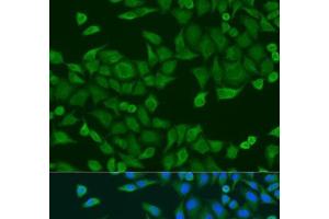 Immunofluorescence analysis of U2OS cells using RPS27A Polyclonal Antibody at dilution of 1:100. (RPS27A Antikörper)