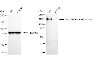 Western blotting analysis using neurofilament medium chain antibody (ABIN7799580).