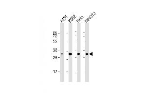 All lanes : Anti-CDK5 Antibody at 1:2000 dilution Lane 1: A431 whole cell lysate Lane 2: K562 whole cell lysate Lane 3: Hela whole cell lysate Lane 4: NIH/3T3 whole cell lysate Lysates/proteins at 20 μg per lane. (CDK5 Antikörper)