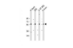 Western Blot at 1:2000 dilution Lane 1: H. (ENTPD2 Antikörper  (N-Term))