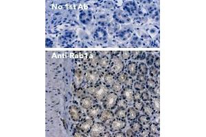 Immunohistochemistry (IHC) image for anti-RAB1A, Member RAS Oncogene Family (RAB1A) (C-Term) antibody (ABIN7272978) (RAB1A Antikörper  (C-Term))