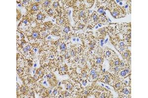 Immunohistochemistry of paraffin-embedded Human liver using GATM Polyclonal Antibody at dilution of 1:100 (40x lens). (GATM Antikörper)