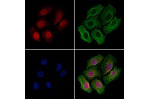 ABIN6263773 and ABIN6279619 staining Hela cells by IF/ICC. (NUP153 Antikörper  (C-Term))