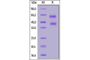 Human IL-2RB&IL-2RG Heterodimer Protein, His Tag&T Tag on  under reducing (R) condition.