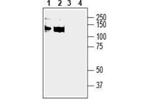 Western blot analysis of human  monocytic leukemia cell line lysate (lanes 1 and 3) and human  megakaryoblastic leukemia cell line lysate (lanes 2 and 4):1,2. (Anoctamin 6 (ANO6) Peptid)