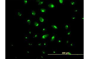 Immunofluorescence of purified MaxPab antibody to ATP2C1 on HeLa cell. (ATP2C1 Antikörper  (AA 1-919))